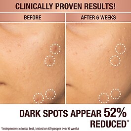 Dark Spot Correcting Radiance Recovery Serum - Serum gegen Flecken